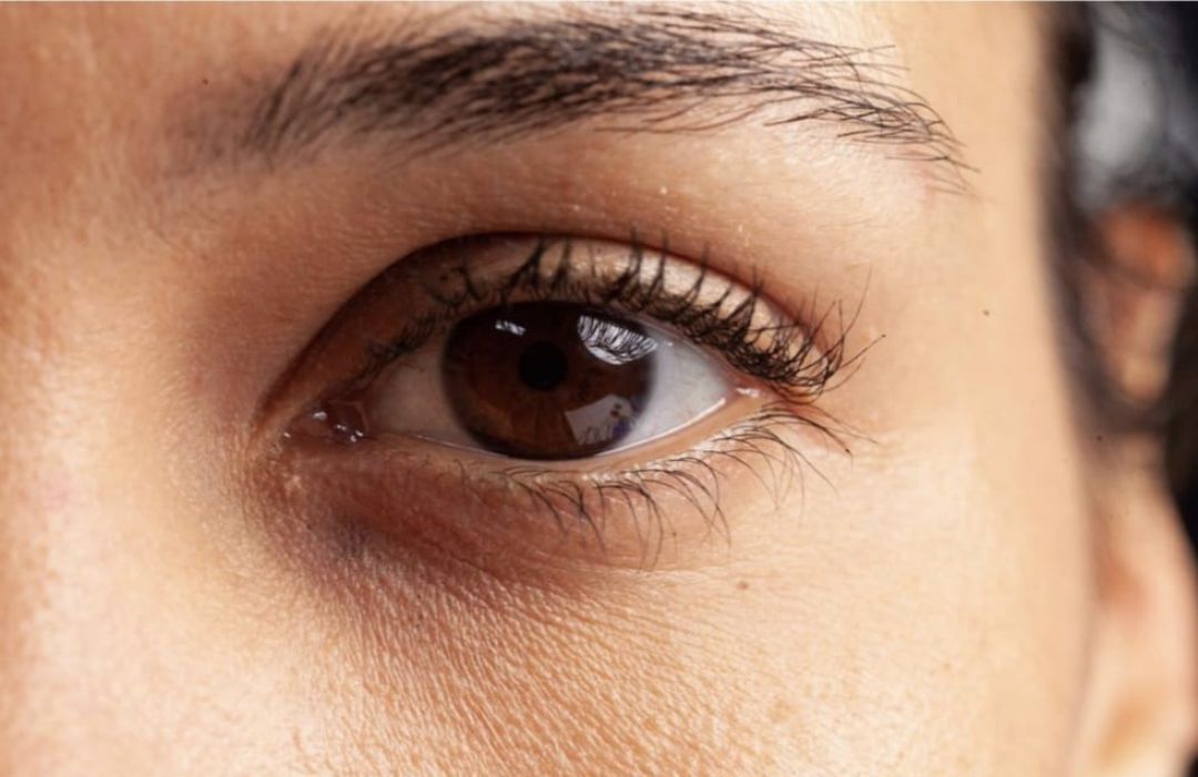 Cuidados de la piel debajo de los ojos, la más sensible