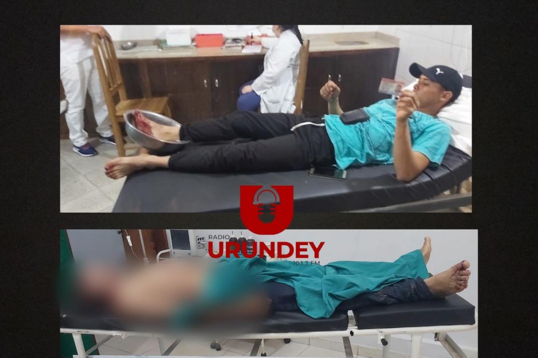 Hombre fallece tras accidente en moto sobre un puente en Yby Yaú