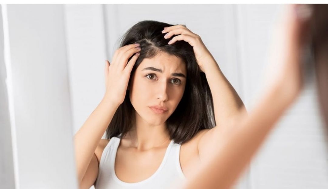 Cómo prevenir la caspa y qué hacer si ya apareció