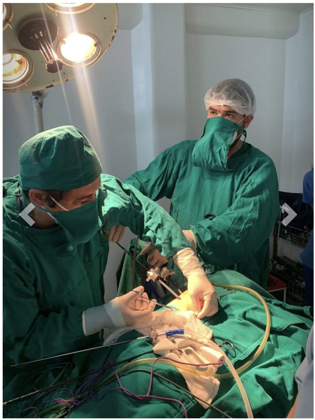 Hernia diafragmática congénita: se realizó la primera cirugía correctiva por toracoscopía en el país