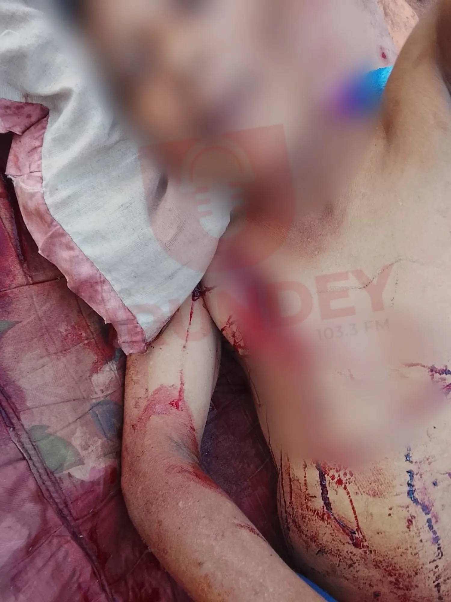 Navidad violenta en Cerro Corá: hombre es herido a machetazos por su familiar