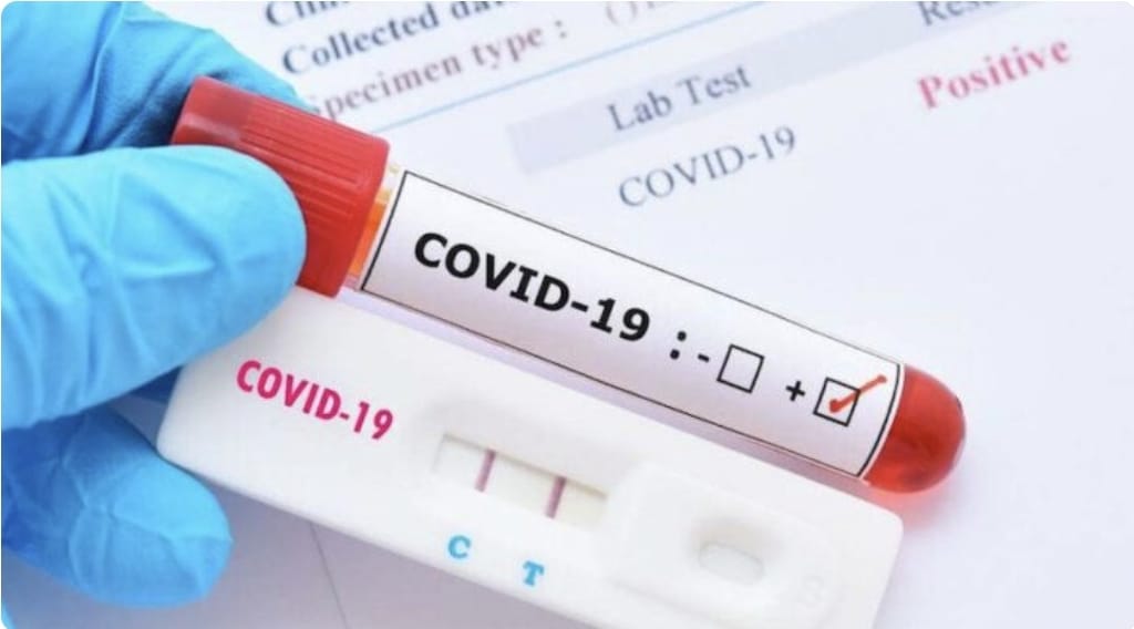 Más de 1.300 nuevos casos positivos de COVID-19 en una semana