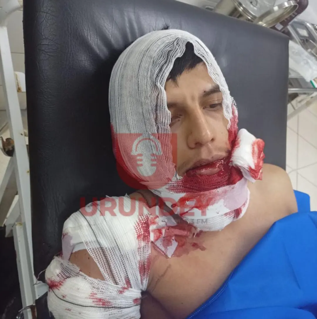 Joven fue herido de un balazo en Capitán Bado y el autor sería el hermano de su pareja