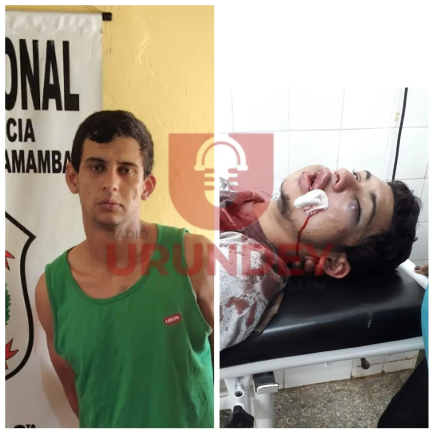 De víctima de sicariato a ladrón: Detenido por asalto en PJC fue herido de bala en el rostro años atrás