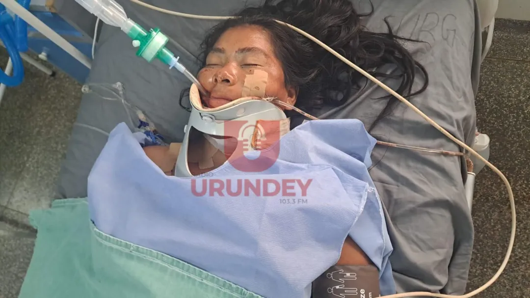 Identifican a mujer que quedó en grave estado tras accidente que involucra a un juez en PJC