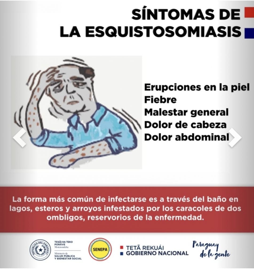 Esquistosomiasis, ¿Qué es y cómo se transmite?