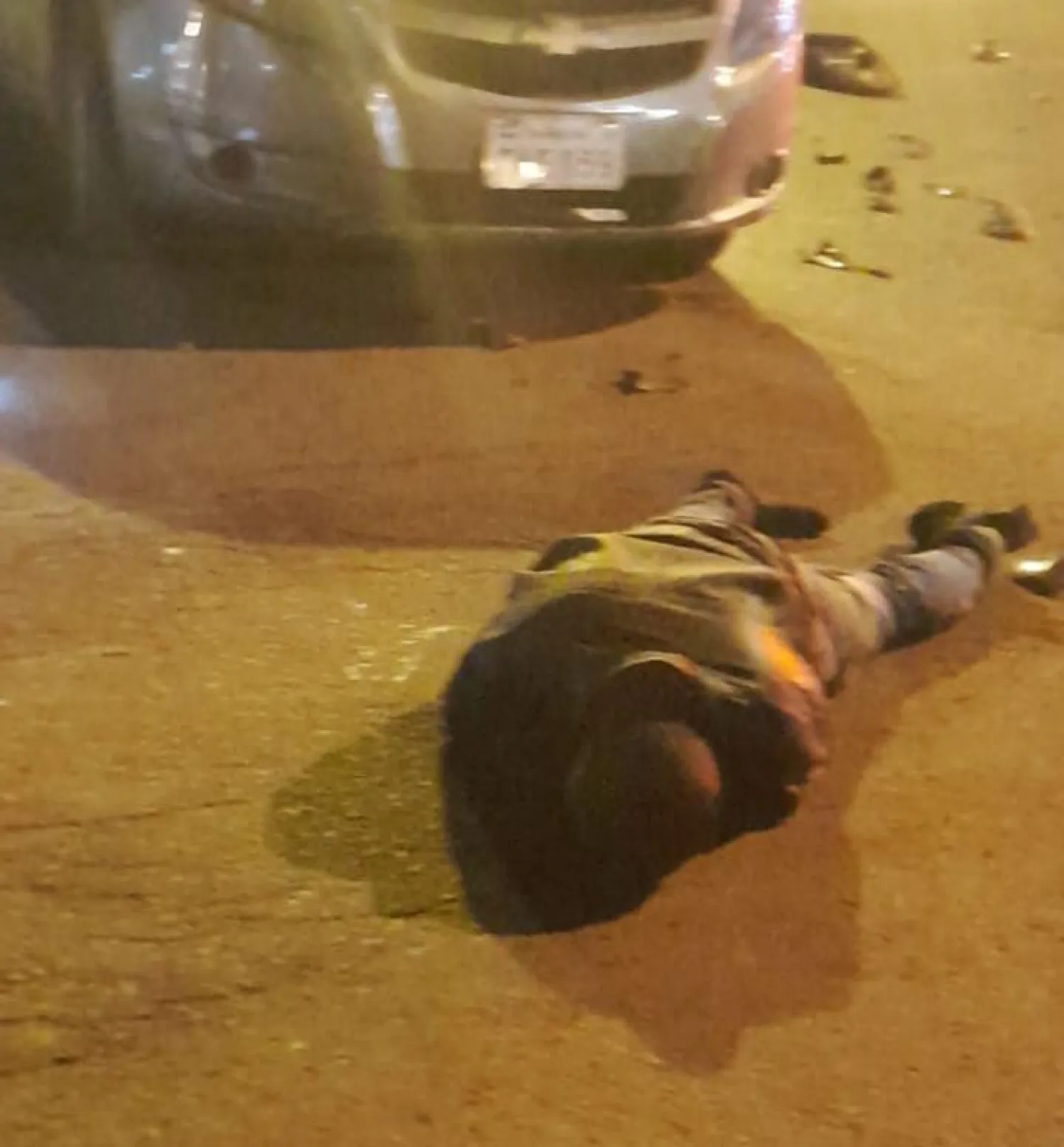 Accidente de tránsito en Pedro Juan Caballero deja a un motociclista con fractura
