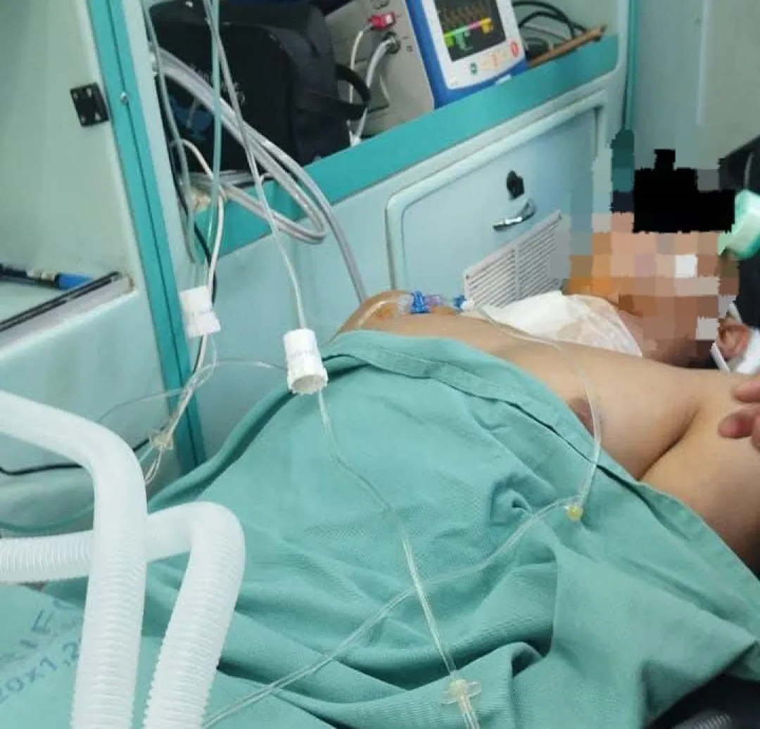 Delivery que fue embestido por camioneta en Bella Vista sigue grave y lucha por su vida
