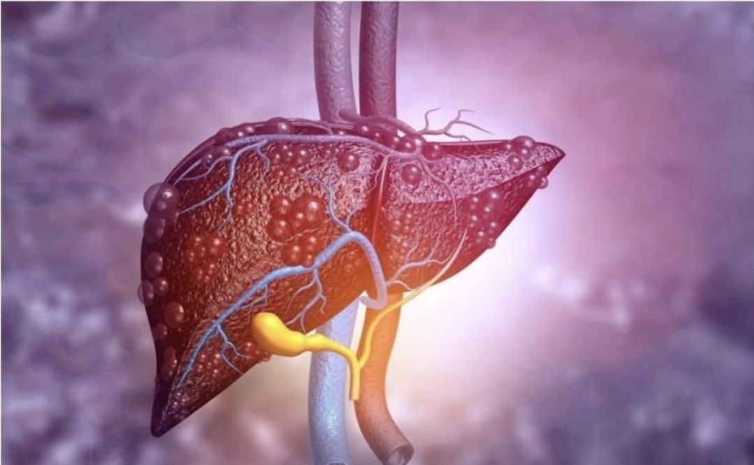 Cómo cuidar el hígado con 5 alimentos