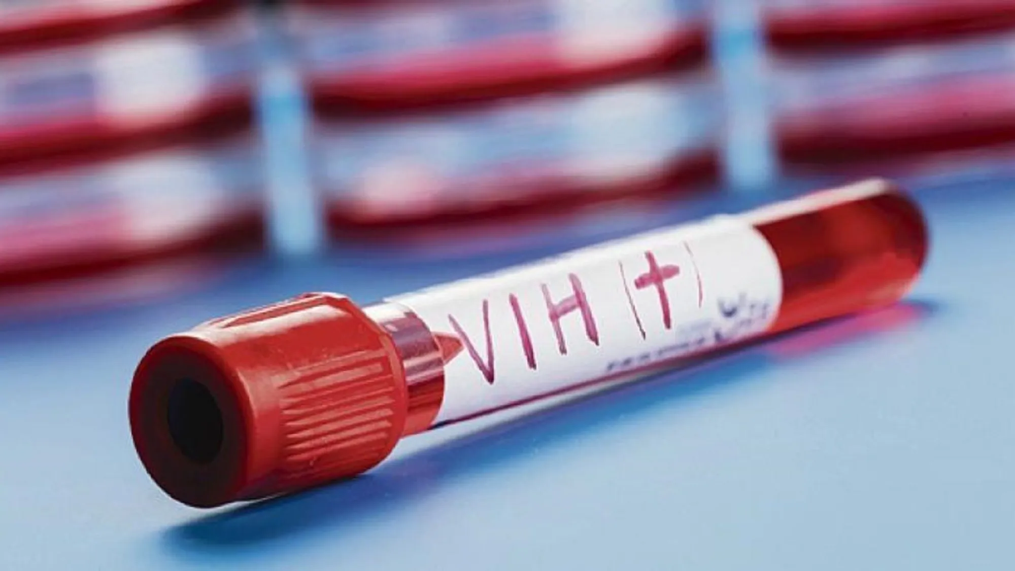 Más infecciones, pero menos muertes por VIH en América Latina en 2023 respecto a 2010
