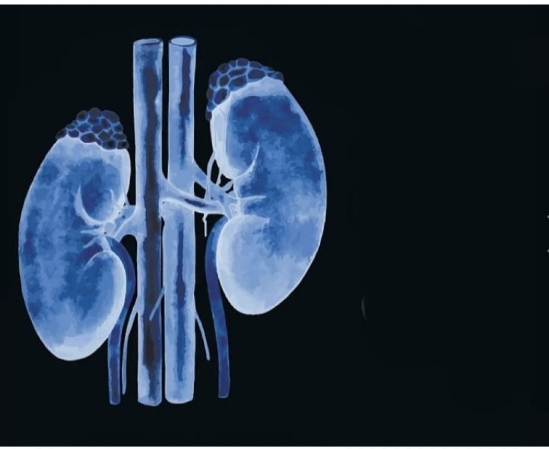 Día Mundial del Cáncer de Riñón: concienciar e informar para una detección temprana