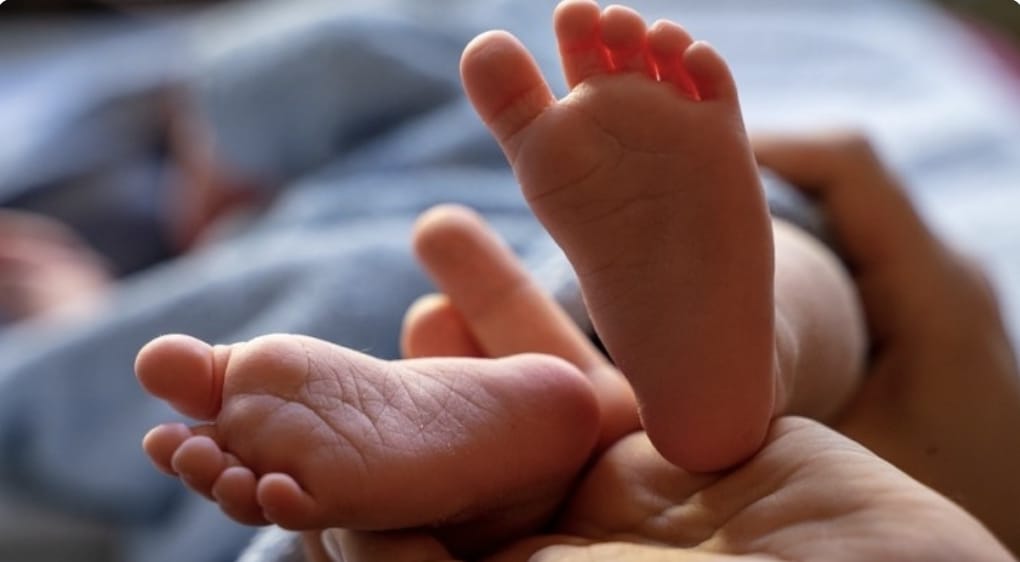 Piden ampliar inmunización contra VSR a niños y niñas con síndrome de Down