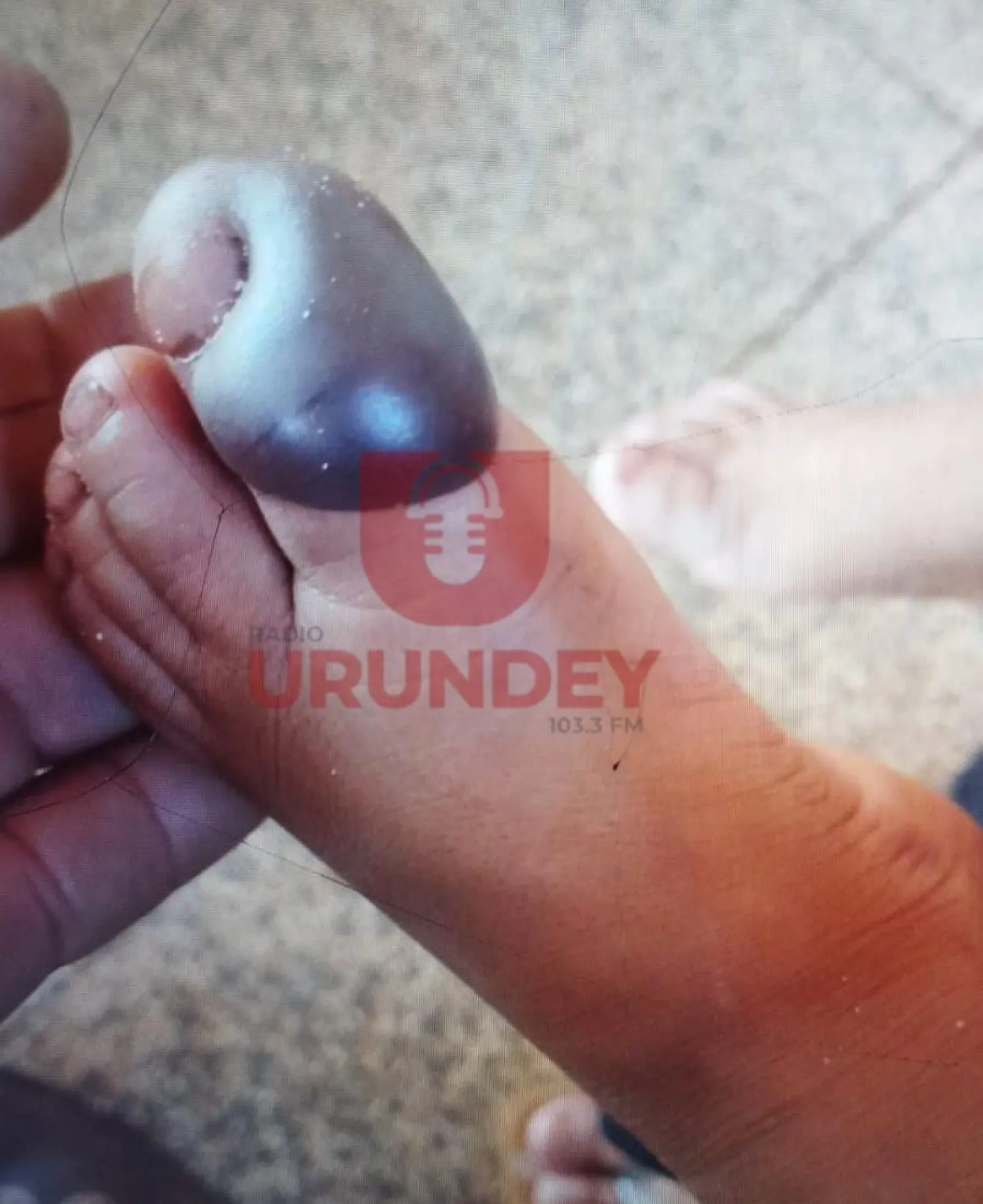 Un niño de dos años sobrevive tras ser mordido por una serpiente en Bella Vista Norte