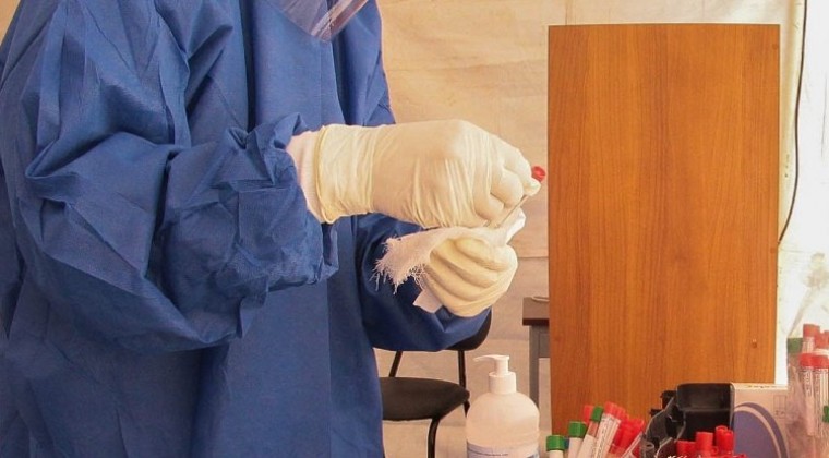 Salud reporta 21 fallecimientos por COVID-19 en una semana