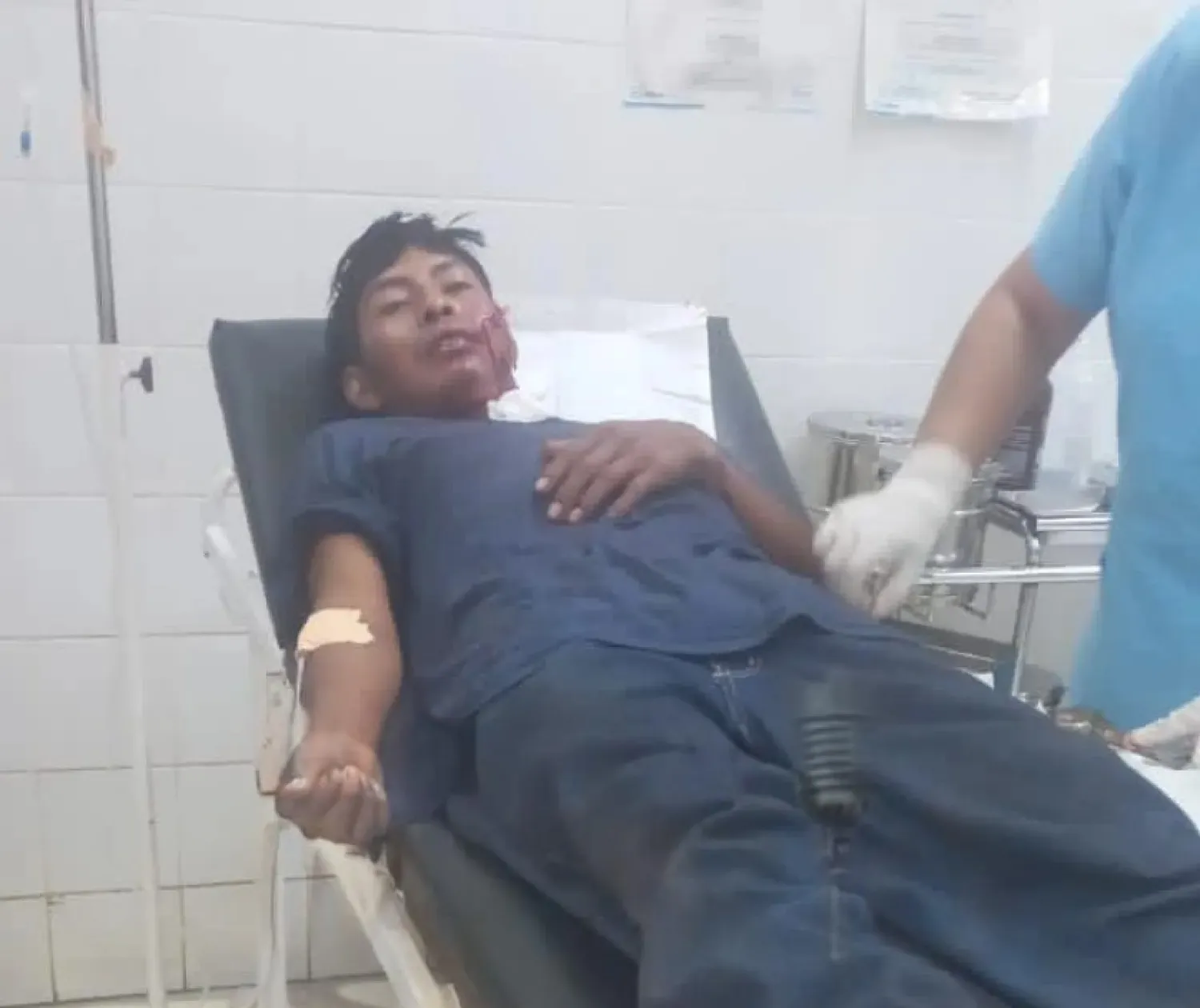 Joven hospitalizado tras ser atacado y herido con machete en Capitán Bado