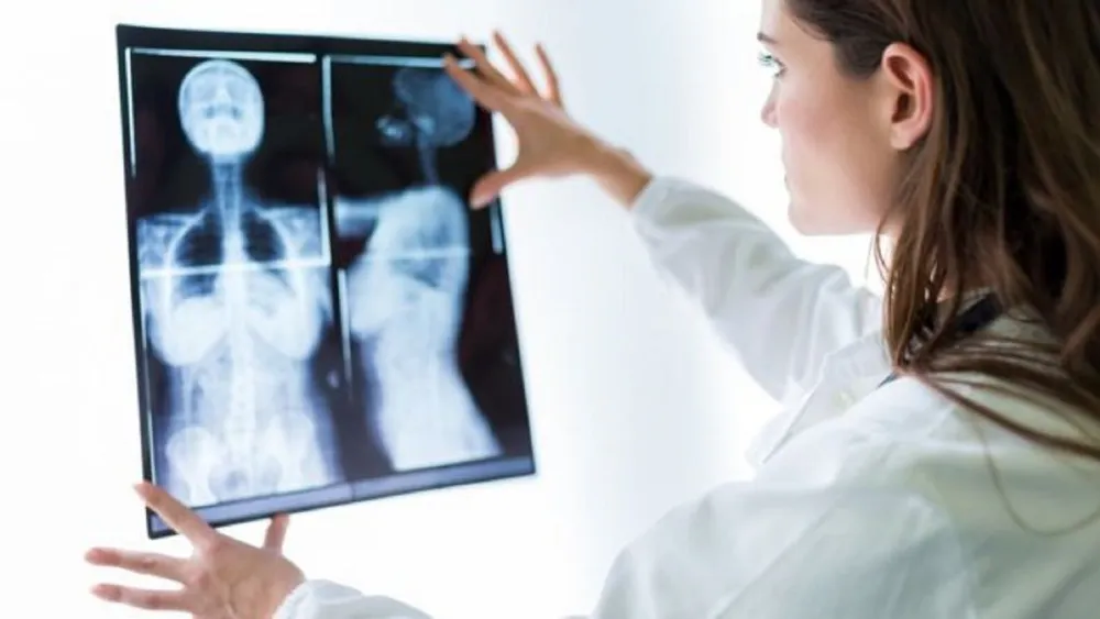 Mamografías apoyadas por IA aumentan un 20% la detección del cáncer de mama