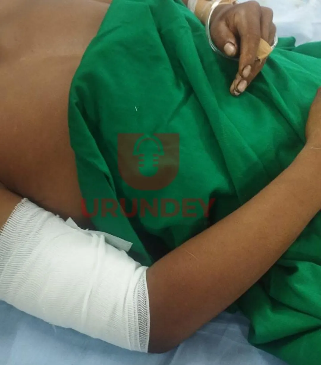 Adolescente de 17 años resulta herido por disparo accidental en Cerro Corá