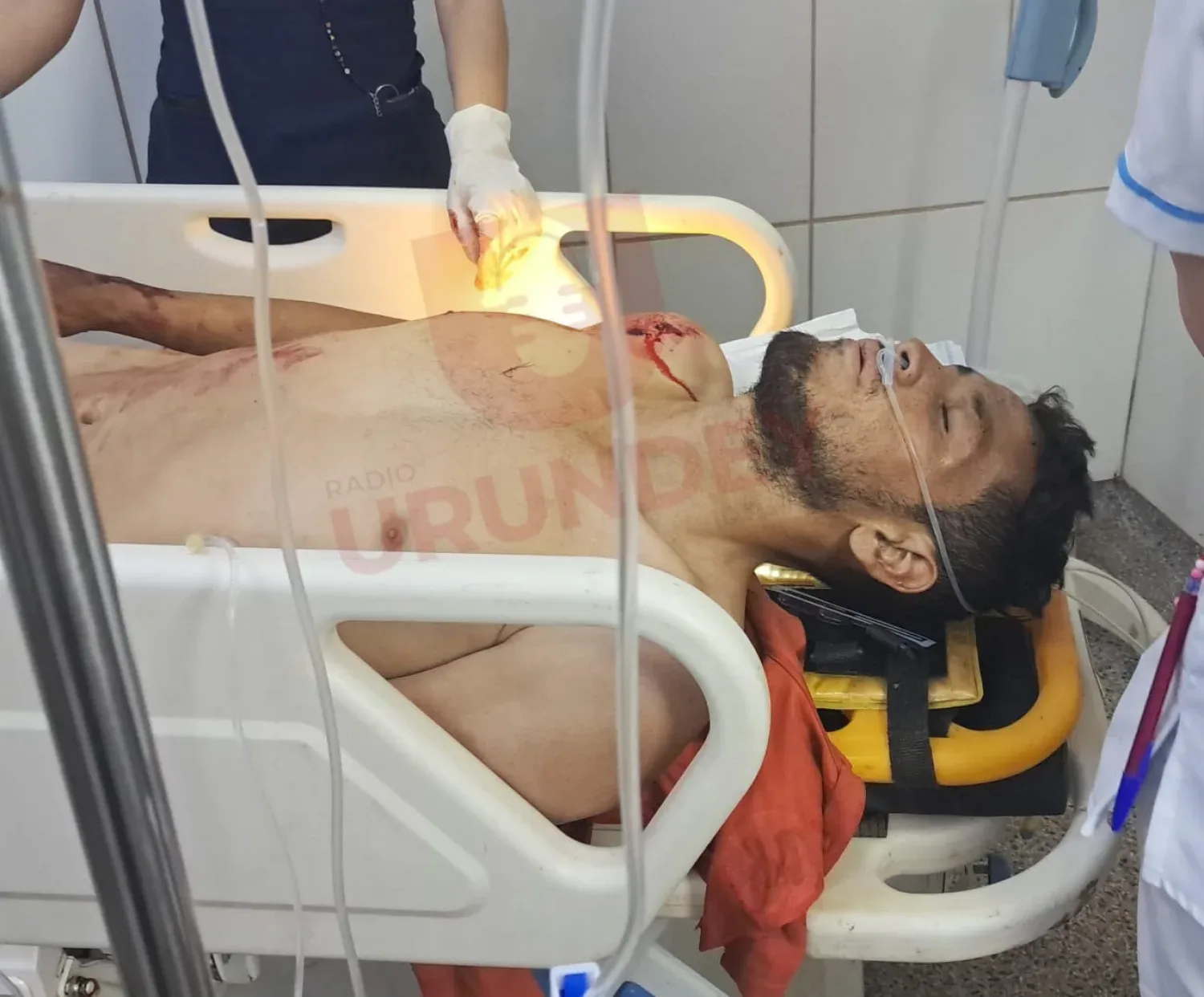Evoluciona en forma favorable el joven que sufrió cinco impactos de bala en Pedro Juan