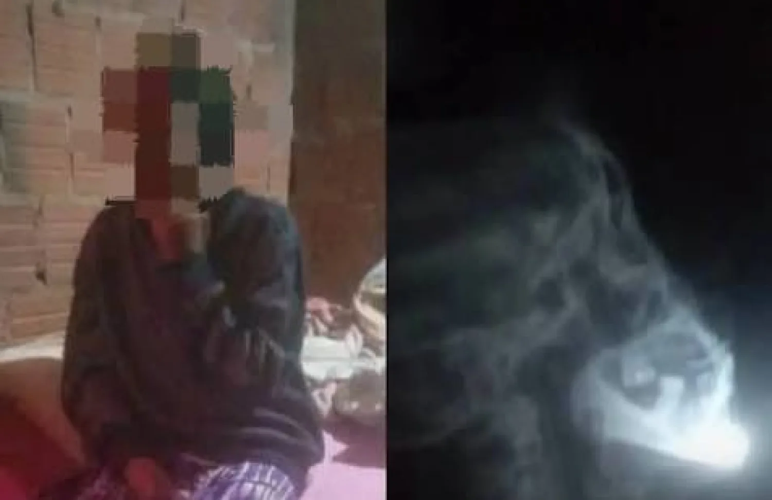 Estudios médicos no detectan hueso en garganta de paciente internada en Pedro Juan