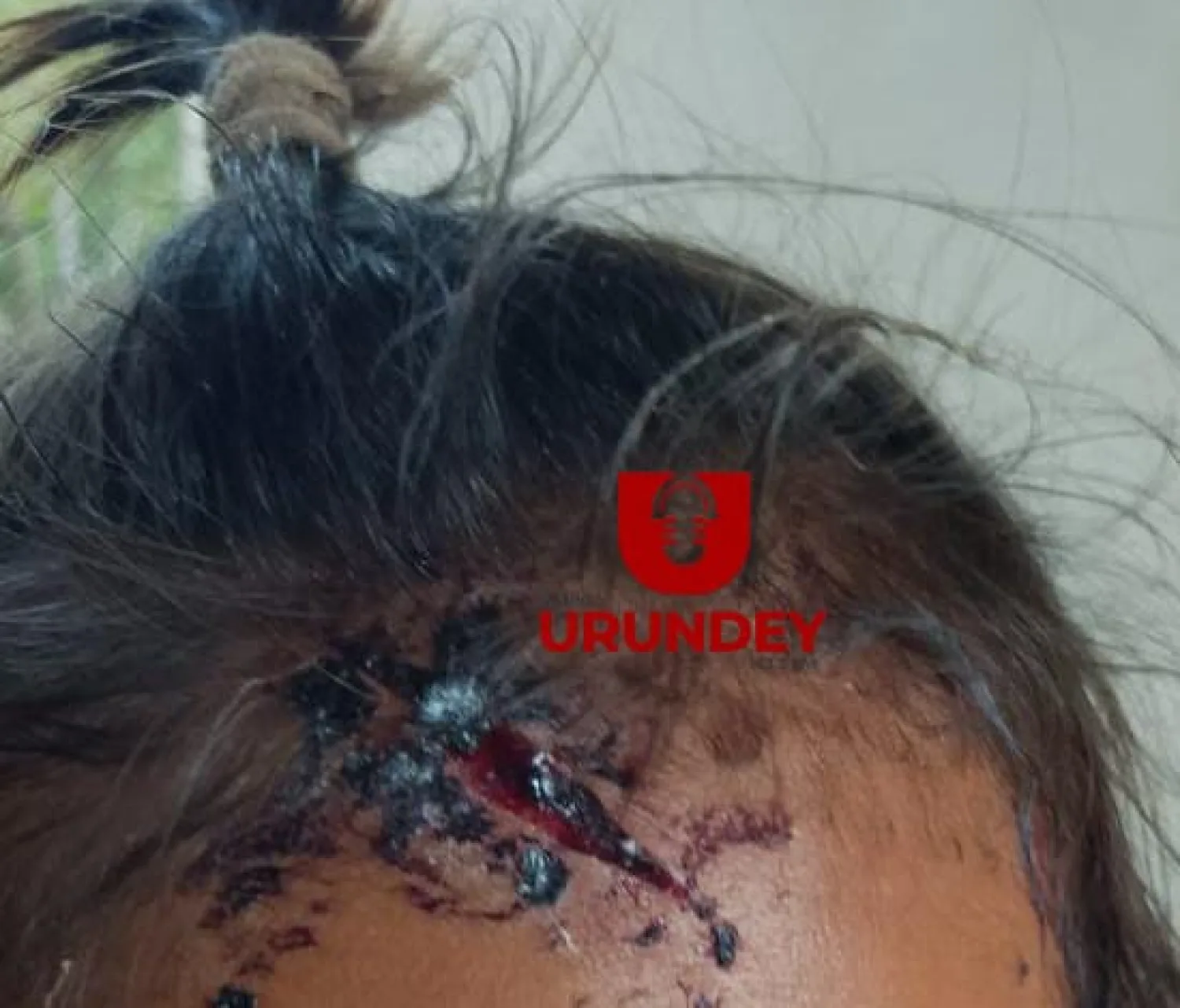 Aprehenden a un hombre por agredir a su hija de un año en el distrito de Cerro Corá