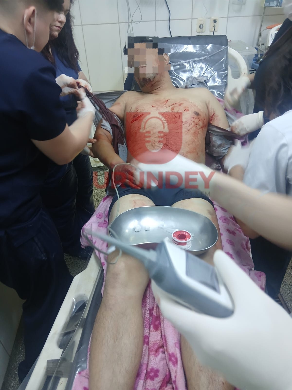 Un hombre atacó a puñaladas al acompañante de su expareja en Pedro Juan Caballero