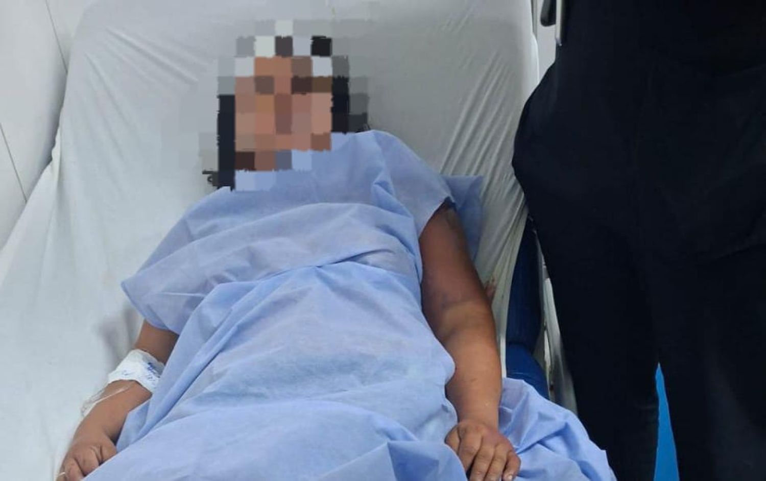 Paraguaya sufre graves lesiones tras ser torturada por su concubino en Ponta Porã